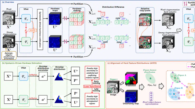 Scribble-Supervised Multi-Organ Segmentation via Epistemic-Driven Hardness-Adaptive Focusing